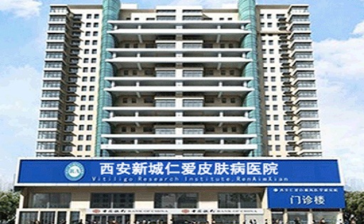 白癜风的发病原因